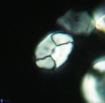 Calculites obscurus 3863