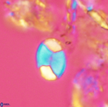 Calculites obscurus 3910