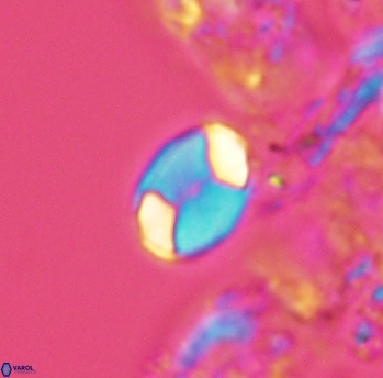 Calculites obscurus 3911