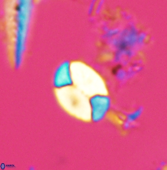 Calculites obscurus 4947