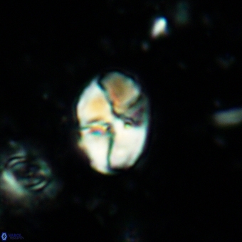 Calculites additus 5487