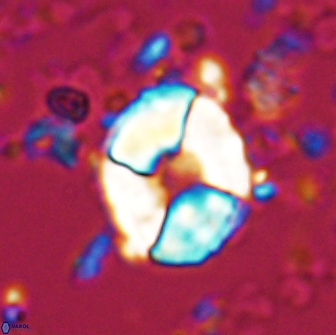 Calculites koilos 18201