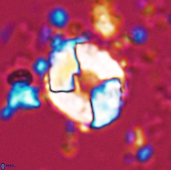 Calculites koilos 18203