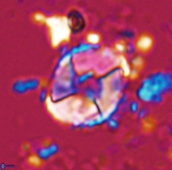 Calculites koilos 18205