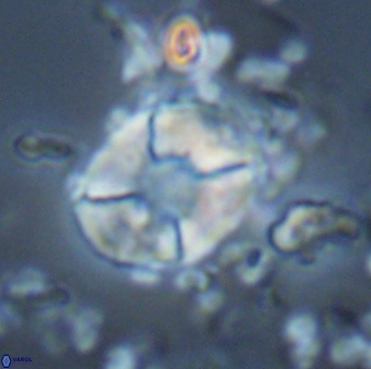 Calculites koilos 18208