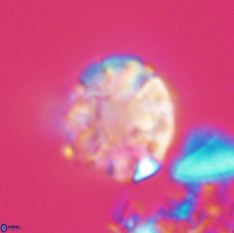 Calculites kratiras 16614