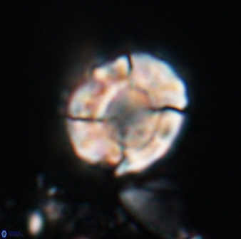 Calculites kratiras 16615