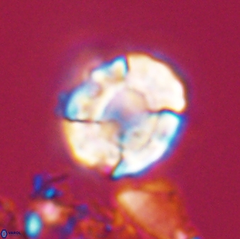 Calculites kratiras 16616