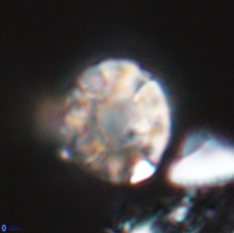 Calculites kratiras 16613