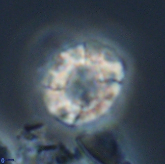 Calculites kratiras 16624