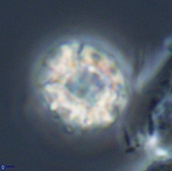 Calculites kratiras 16620