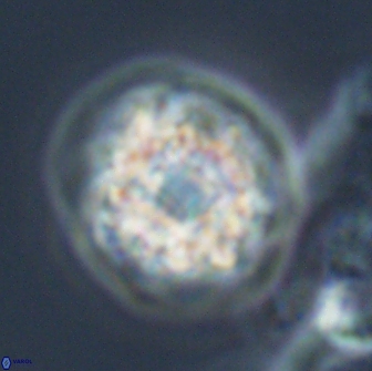 Calculites kratiras 16621