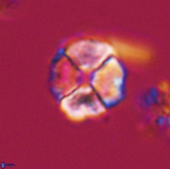 Calculites kratiras 16735