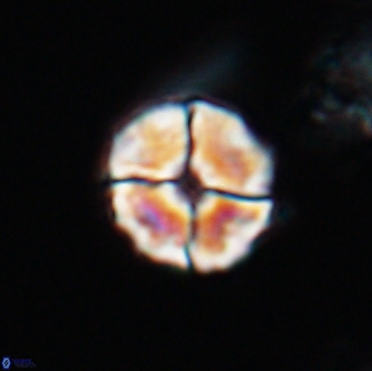 Calculites kratiras 16730