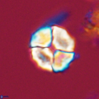 Calculites kratiras 16731