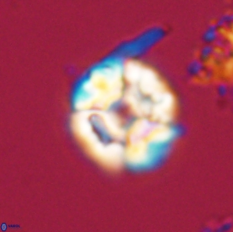 Calculites kratiras 16733