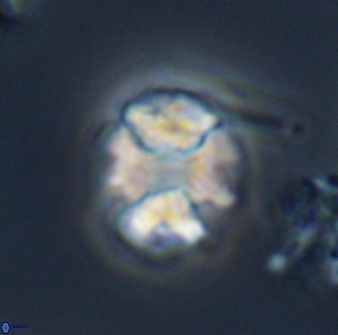 Calculites kratiras 16745