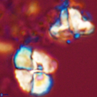 Calculites rhachis 16800