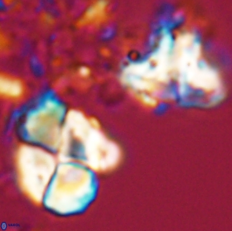 Calculites rhachis 16801