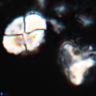 Calculites rhachis 16803