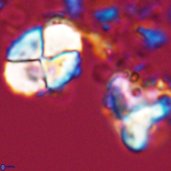 Calculites rhachis 16804