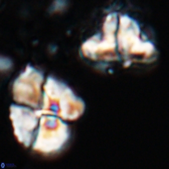 Calculites rhachis 16805