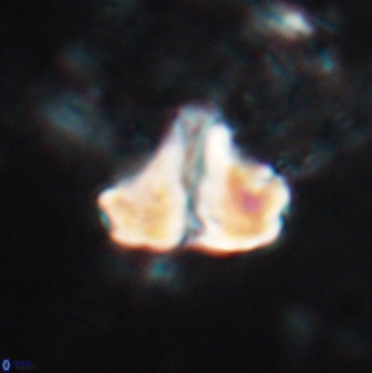 Calculites spp 16928