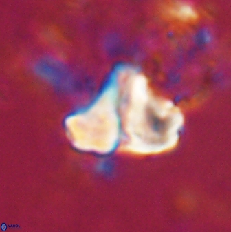 Calculites spp 16929