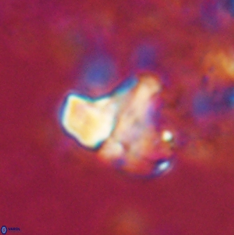 Calculites spp 16933