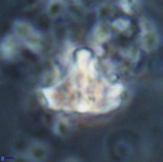 Calculites spp 16935