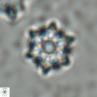 Catinaster magnificus 26465
