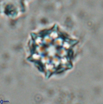 Catinaster magnificus 26466