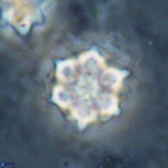 Catinaster magnificus 26472