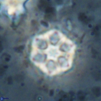 Catinaster magnificus 26473