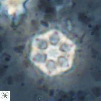 Catinaster magnificus 26473