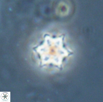 Catinaster magnificus 26583