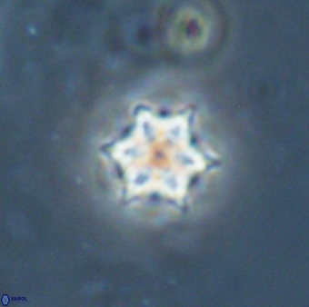 Catinaster magnificus 26585