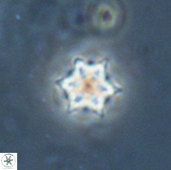 Catinaster magnificus 26585