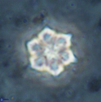 Catinaster magnificus 26851