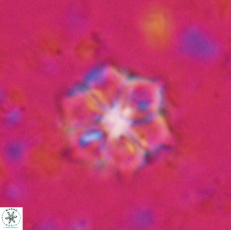 Catinaster magnificus 26855