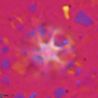 Catinaster magnificus 26856