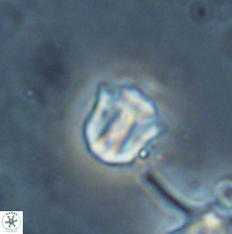 Catinaster coalitus 26354