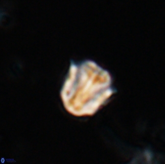 Catinaster coalitus 26363