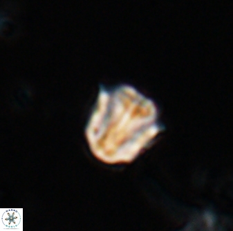 Catinaster coalitus 26363