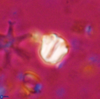 Catinaster coalitus 26694