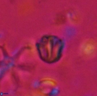 Catinaster coalitus 26695