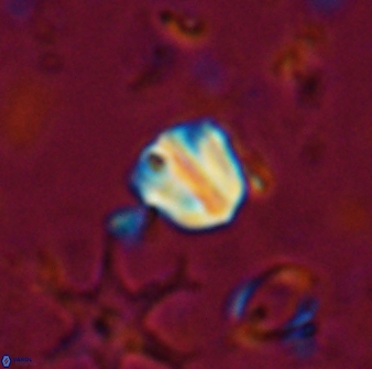 Catinaster coalitus 26697