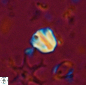 Catinaster coalitus 26697