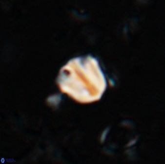 Catinaster coalitus 26698