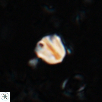 Catinaster coalitus 26698
